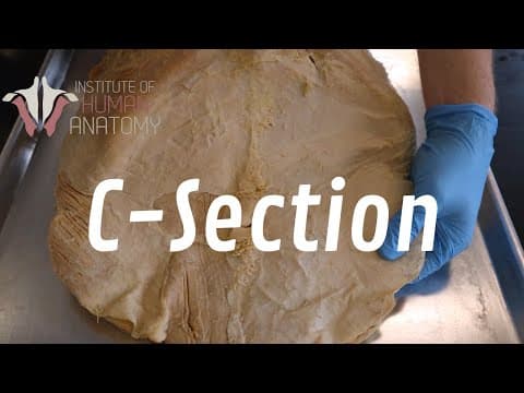 Anatomy of Movement: Muscles, Bones & Joints